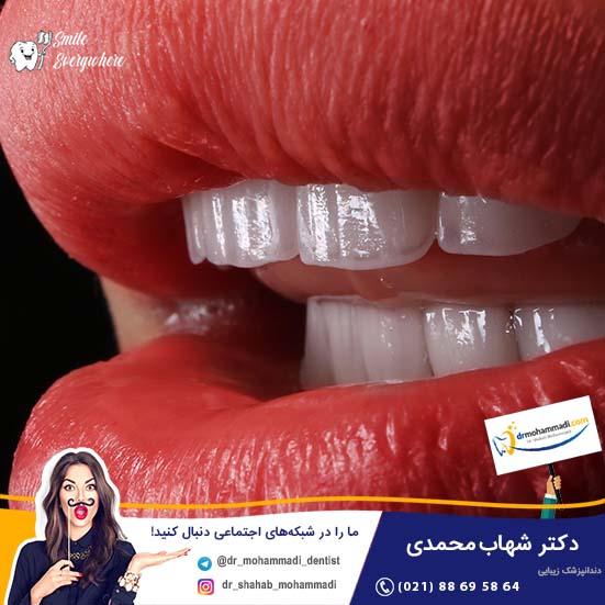 ارتودنسی با لیزر چه تفاوتی با لمینت دندان دارد؟ - کلینیک دندانپزشکی دکتر شهاب محمدی